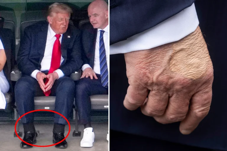 USA : Le président Trump atteint d’une grave maladie USA : Le président Trump atteint d'une grave maladie